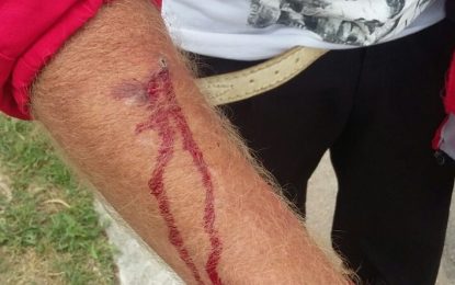 Atacaron a un vecino realiquense para robarle y le provocaron un corte con un cuchillo