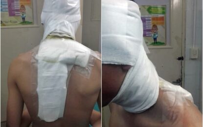 En el Parque Rojo: una persona quemó con agua caliente a un jugador juvenil de Pico FBC